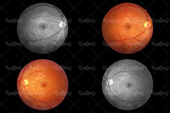 retina