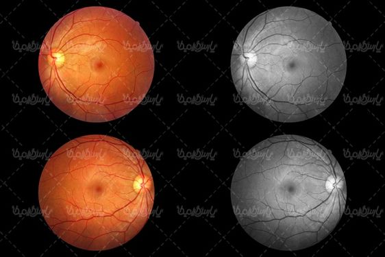 retina