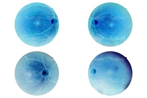 retina