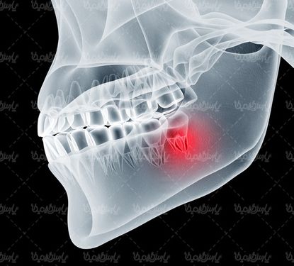 Body radiograph