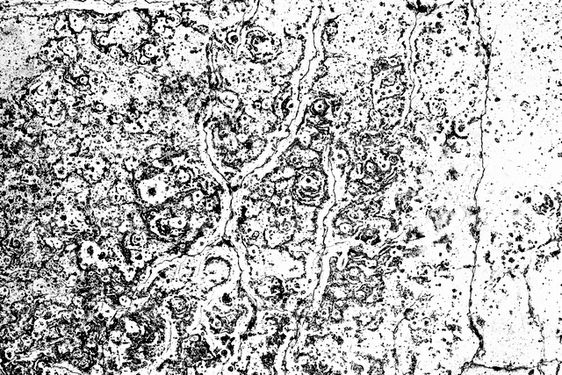 Background texture