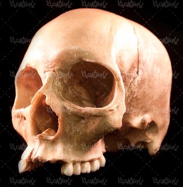 skull