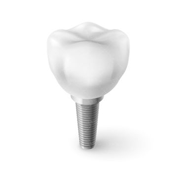 وکتور دندان دندان پزشکی دندان سفید کاشت دندان ایمپلنت