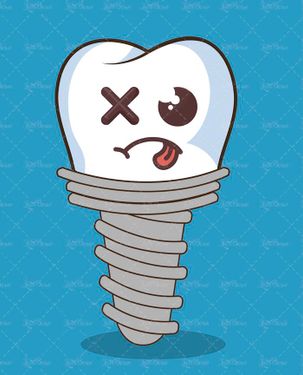 وکتور دندان پزشکی وکتور ایمپلنت وکتور کاشت دندان 2