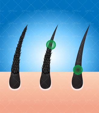 وکتور موی سالم وکتور موی نرم وکتور موی آسیب دیده1