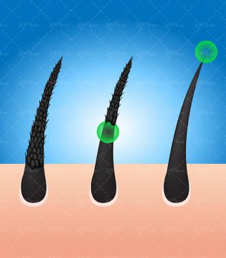 وکتور موی سالم وکتور موی نرم وکتور موی آسیب دیده2