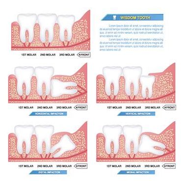 وکتور اینفوگرافی دندان پزشکی