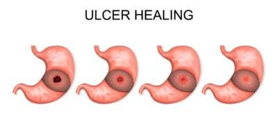 وکتور پزشکی وکتور معده