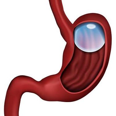 وکتور دوازدهه وکتور امعاء و احشاء بدن