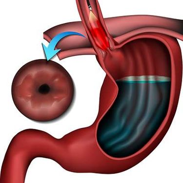وکتور دوازدهه وکتور امعاء و احشاء بدن