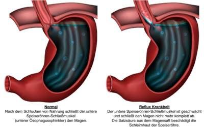 وکتور دوازدهه وکتور امعاء و احشاء بدن