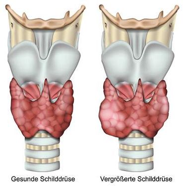 غده تیروئید وکتور  امعاء و احشاء بدن