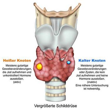 غده تیروئید وکتور  امعاء و احشاء بدن