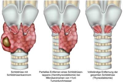 غده تیروئید وکتور  امعاء و احشاء بدن