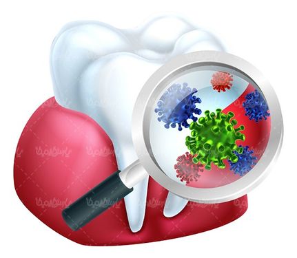 Dental vector