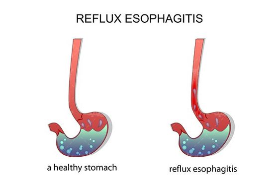 Stomach vector