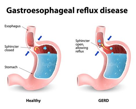 Stomach vector