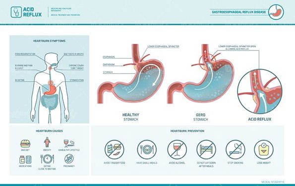 Stomach vector