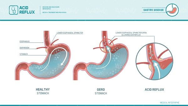 Stomach vector