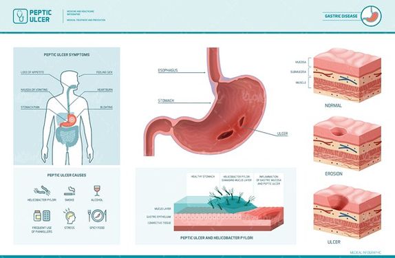 Stomach vector