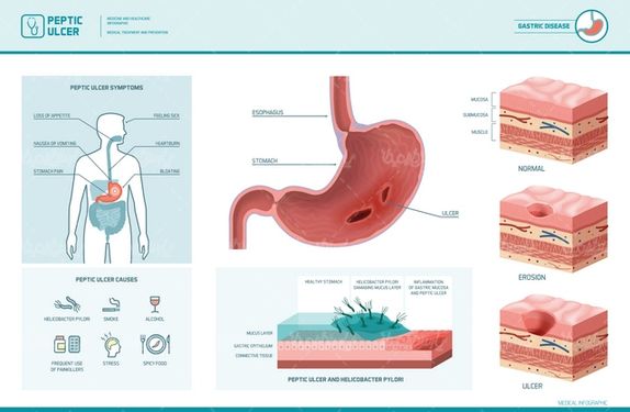 Gastric vector